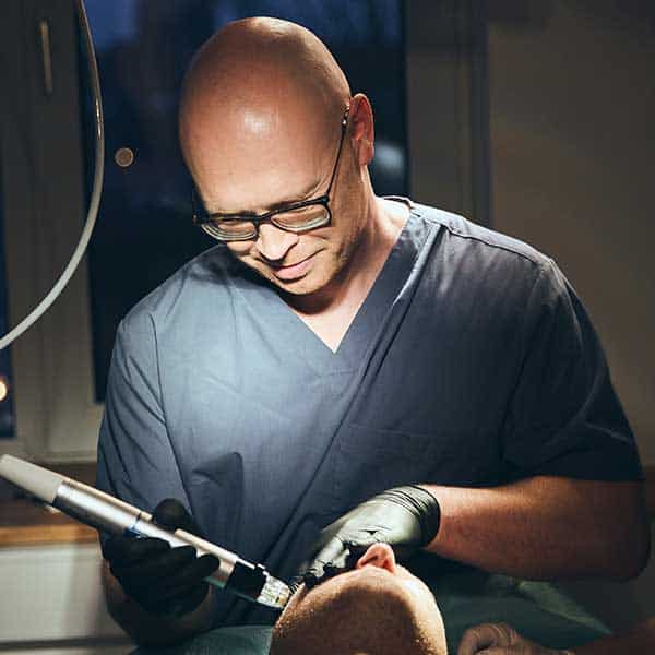 acnescar treatment microneedling