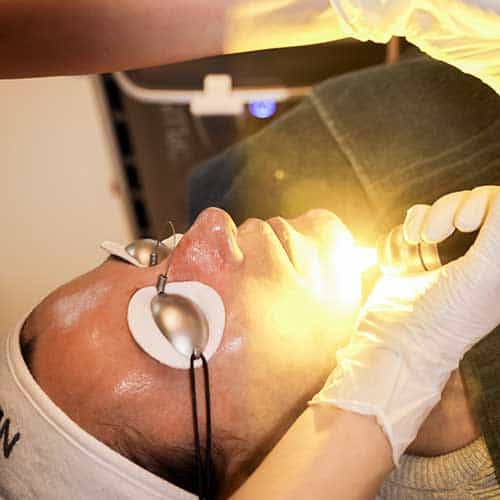 rejuvenation hudforyngelse med laser