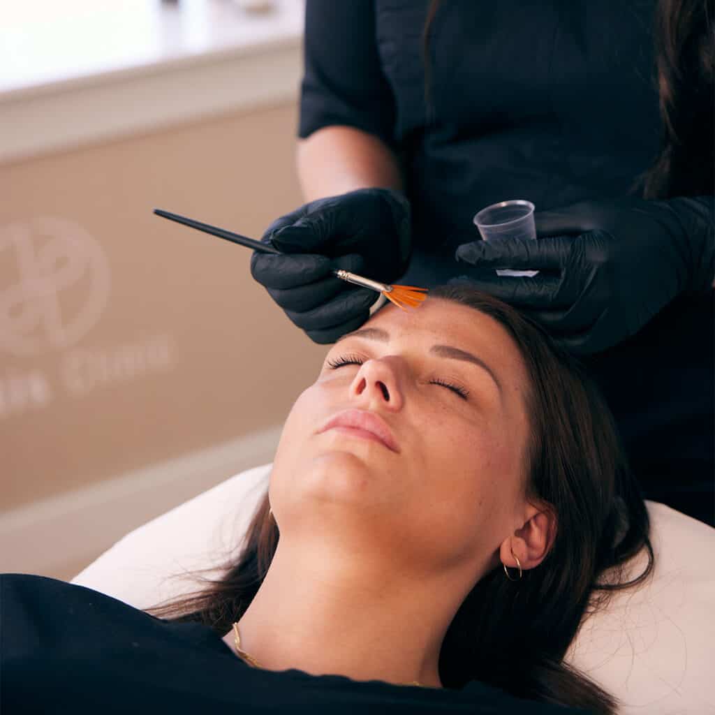 kemisk peeling med glykolsyre