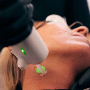 rejuvenation hudforyngende og hudfornyende laserbehandling