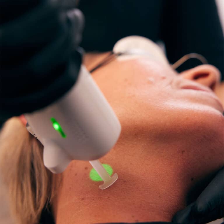 rejuvenation hudforyngende og hudfornyende laserbehandling