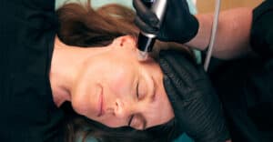 genius behandling microneedling