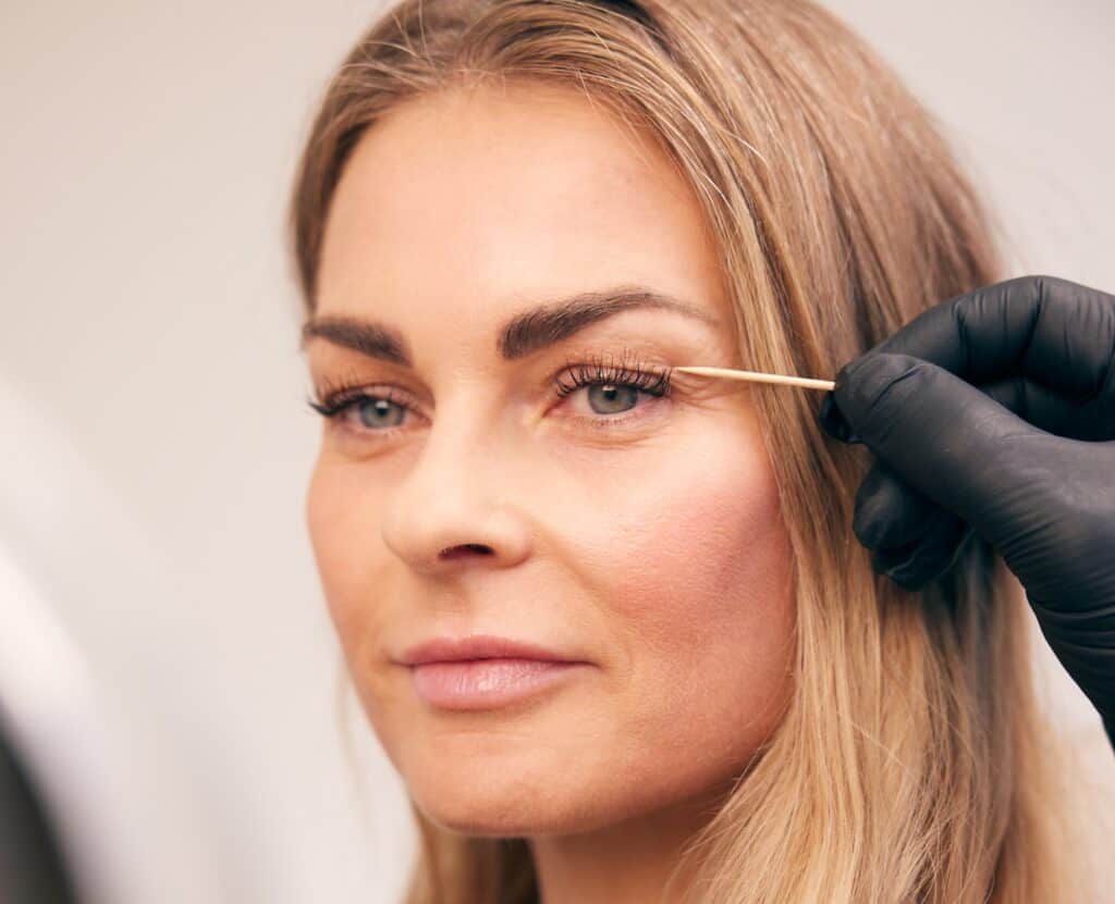 Øjenlågsoperation mod poser under øjnene hos Cutis Clinic
